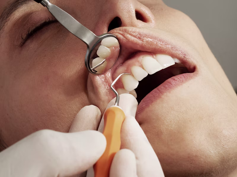 implantes dentales en Opañel